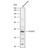 Solarbio K110123P Anti-HOXD3 Polyclonal Antibody