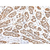 Solarbio K007230P Anti-YY1 Polyclonal Antibody