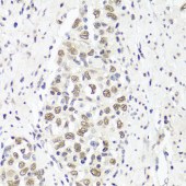 Solarbio K001766P Anti-PARP Polyclonal Antibody
