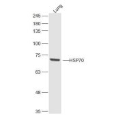 Solarbio K009465P Anti-HSP70 Polyclonal Antibody