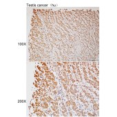 Solarbio K112179P Anti-TNS3 Polyclonal Antibody