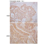 Solarbio K110311P Anti-AGPAT4 Polyclonal Antibody