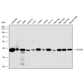 Solarbio K112298P Anti-ACAA2 Polyclonal Antibody