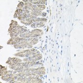 Solarbio K004215P Anti-ATP1B1 Polyclonal Antibody