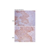 Solarbio K106543P Anti-HSPD1 Polyclonal Antibody