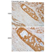 Solarbio K112251P Anti-ERAL1 Polyclonal Antibody