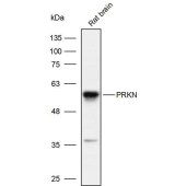 Solarbio K110015P Anti-PRKN Polyclonal Antibody