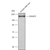 Solarbio K009878P Anti-IQGAP2 Polyclonal Antibody
