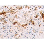 Solarbio K009900P Anti-CAPN6 Polyclonal Antibody