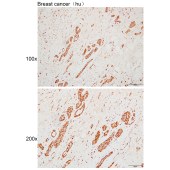 Solarbio K110064P Anti-HNRNPA1 Polyclonal Antibody