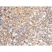 Solarbio K009871P Anti-GLT8D1 Polyclonal Antibody