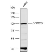 Solarbio K112299P Anti-CCDC33 Polyclonal Antibody