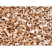 Solarbio K009873P Anti-ZNF639 Polyclonal Antibody