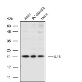 Solarbio K110408P Anti-IL18 Polyclonal Antibody