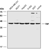 Solarbio K008562P Anti-TBP  Polyclonal Antibody
