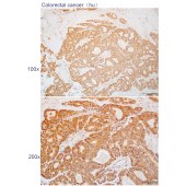 Solarbio K112270P Anti-TSC1 Polyclonal Antibody