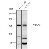 Solarbio K112161P Anti-PNPLA6 Polyclonal Antibody