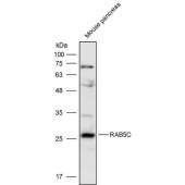 Solarbio K110292P Anti-RAB5C Polyclonal Antibody