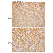 Solarbio K110009P Anti-CYP2S1 Polyclonal Antibody