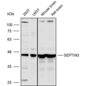 Solarbio K110306P Anti-SEPTIN3 Polyclonal Antibody