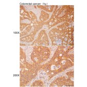 Solarbio K112227P Anti-LAIR1 Polyclonal Antibody