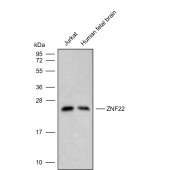 Solarbio K009817P Anti-ZNF22 Polyclonal Antibody