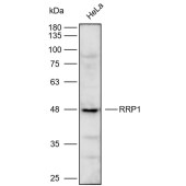 Solarbio K110474P Anti-RRP1 Polyclonal Antibody
