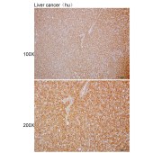 Solarbio K110054P Anti-TNFRSF14 Polyclonal Antibody