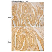 Solarbio K110504P Anti-FABP6 Polyclonal Antibody