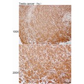Solarbio K112190P Anti-DCC Polyclonal Antibody