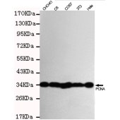 Solarbio K000120M Anti-PCNA Monoclonal Antibody