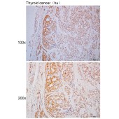 Solarbio K110371P Anti-STK38 Polyclonal Antibody