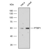 Solarbio K112316P Anti-PTBP1 Polyclonal Antibody