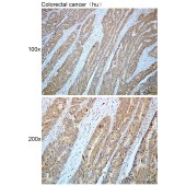 Solarbio K112413P Anti-UBQLN4 Polyclonal Antibody