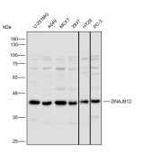 Solarbio K112242P Anti-DNAJB12 Polyclonal Antibody