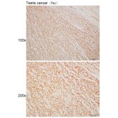 Solarbio K110456P Anti-FTO Polyclonal Antibody