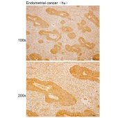Solarbio K110512P Anti-G3BP2 Polyclonal Antibody