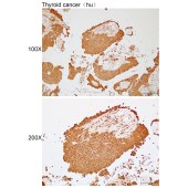 Solarbio K112242P Anti-DNAJB12 Polyclonal Antibody