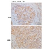 Solarbio K110342P Anti-URGCP Polyclonal Antibody