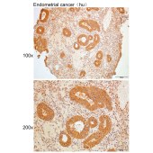 Solarbio K109930P Anti-MRPL12 Polyclonal Antibody