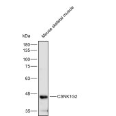 Solarbio K112263P Anti-CSNK1G2 Polyclonal Antibody