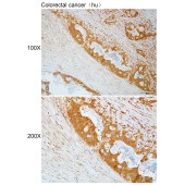 Solarbio K112216P Anti-AMDHD1 Polyclonal Antibody