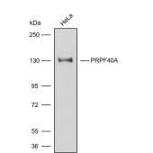 Solarbio K009859P Anti-PRPF40A Polyclonal Antibody