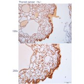 Solarbio K112248P Anti-CIDEC Polyclonal Antibody
