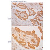 Solarbio K110396P Anti-MFN2 Polyclonal Antibody
