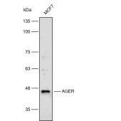 Solarbio K112274P Anti-AGER Polyclonal Antibody