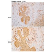 Solarbio K110389P Anti-UQCRFS1 Polyclonal Antibody