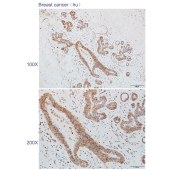 Solarbio K110491P Anti-GEMIN6 Polyclonal Antibody
