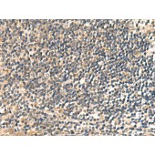 Solarbio K009863P Anti-CNST Polyclonal Antibody
