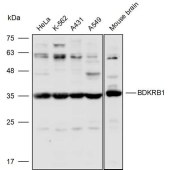 Solarbio K110276P Anti-BDKRB1 Polyclonal Antibody